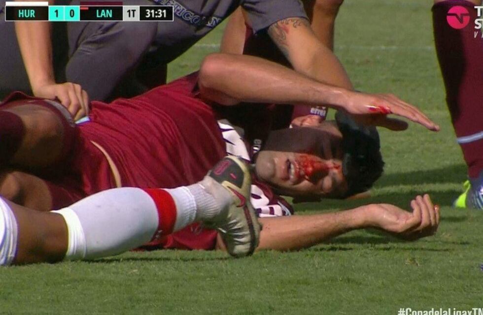 Impresionante choque en Huracán-Lanús: Diego Braghieri salió con cuello ortopédico y fue derivado al hospital