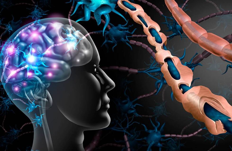 Según un estudio norteamericano, el virus de la mononucleosis podría generar la esclerosis múltiple