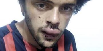 La mayoría de los golpes fueron en su rostro\u002E