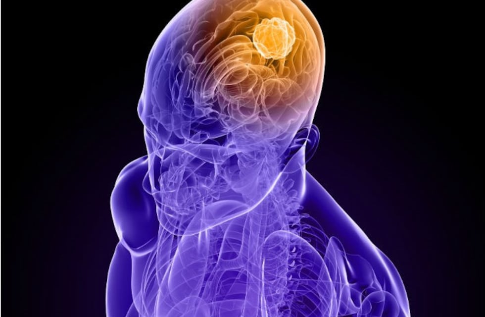 Hay casi 7 mil pacientes en el programa de Epilepsia de Salud Pública en Salta