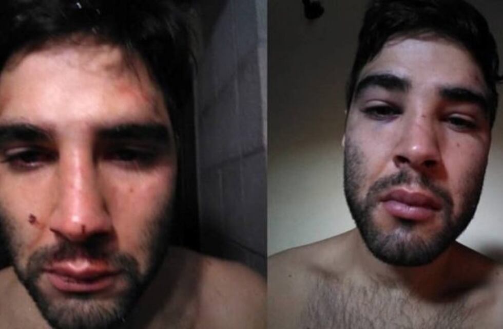 Denunció que patovicas de un boliche puntano le dieron una terrible paliza
