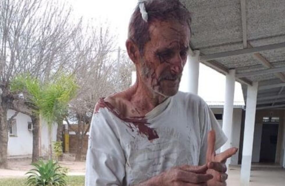 Balearon a un productor cuando se resistió al robo del dinero de la venta de ganado