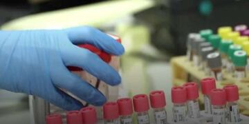 San Luis registró hoy sábado 93 casos positivos de coronavirus y un muerto. Gentileza