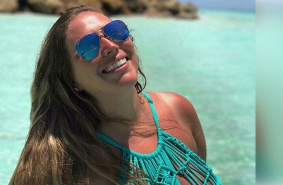 Mar Tarrés mostró la diferencia entre su pierna sana y la que tiene trombosis