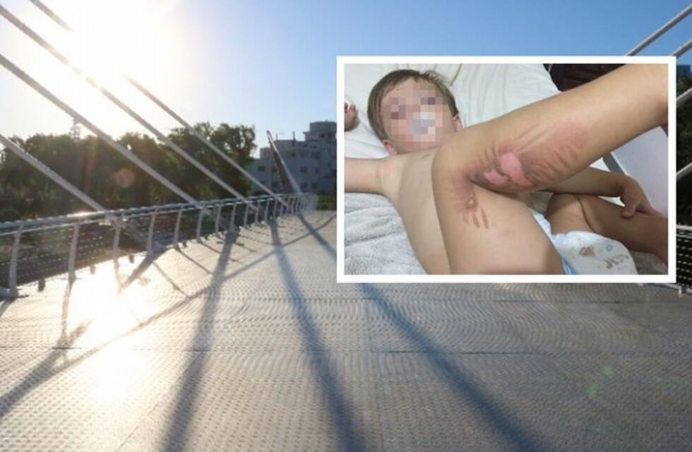 Un niño sufrió quemaduras en el nuevo Puente Peatonal de Carlos Paz