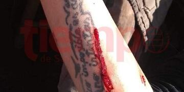 Imágenes sensibles\u002E