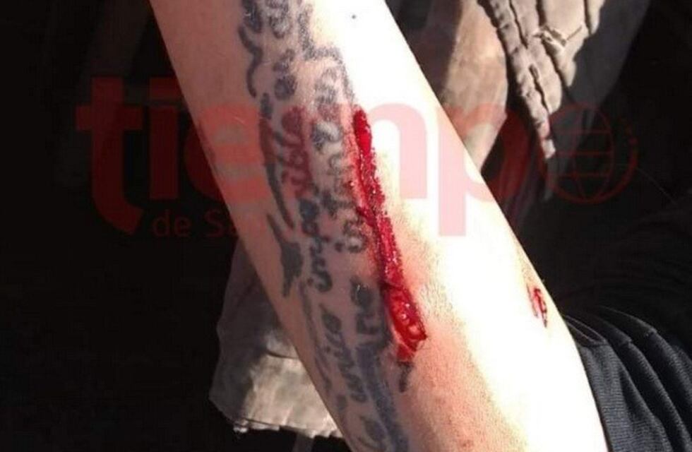 Impactante: se confundió de persona y le desfiguró la cara con un cuchillo