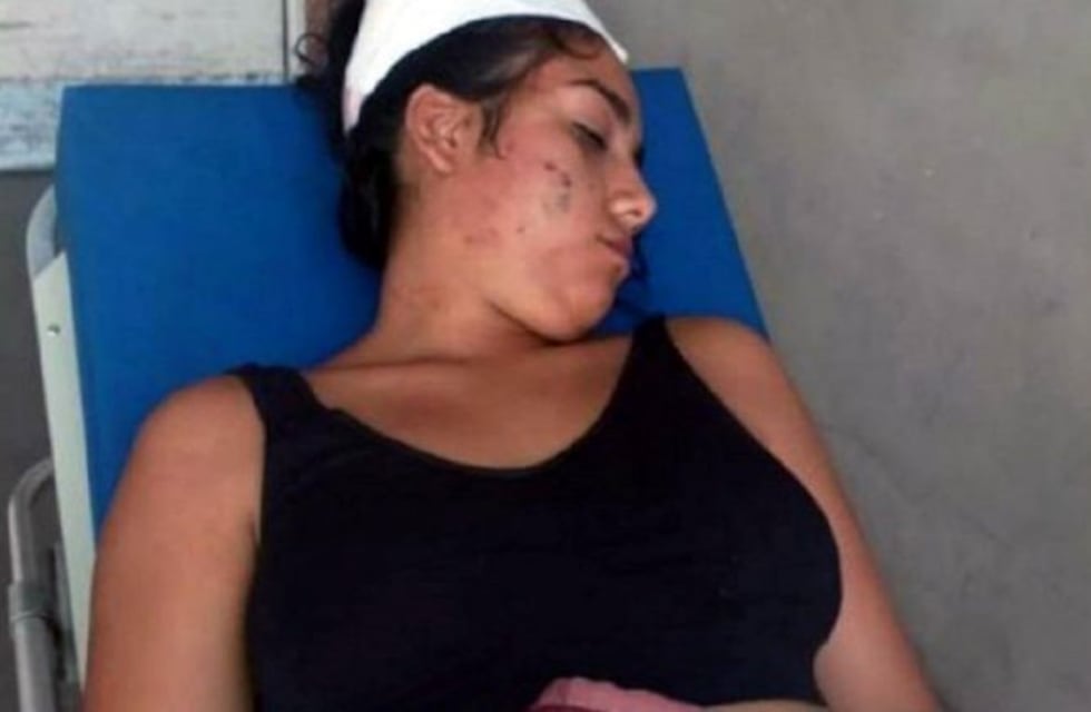 Fue a bailar a Arroyo Seco y quedó internada tras denunciar brutal golpiza
