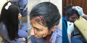 Policías terminaron heridos tras el desalojo del terreno usurpado