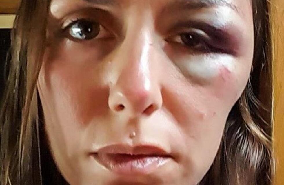 La pesadilla de Andrea, una rosarina atacada en Ecuador