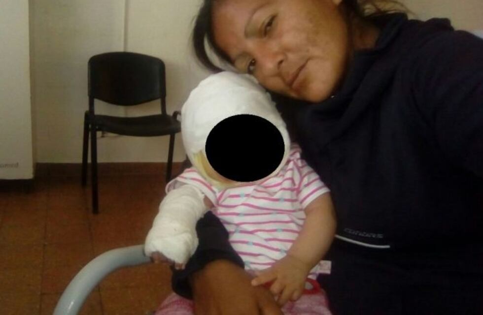 Una beba de dos años está internada tras un incendio