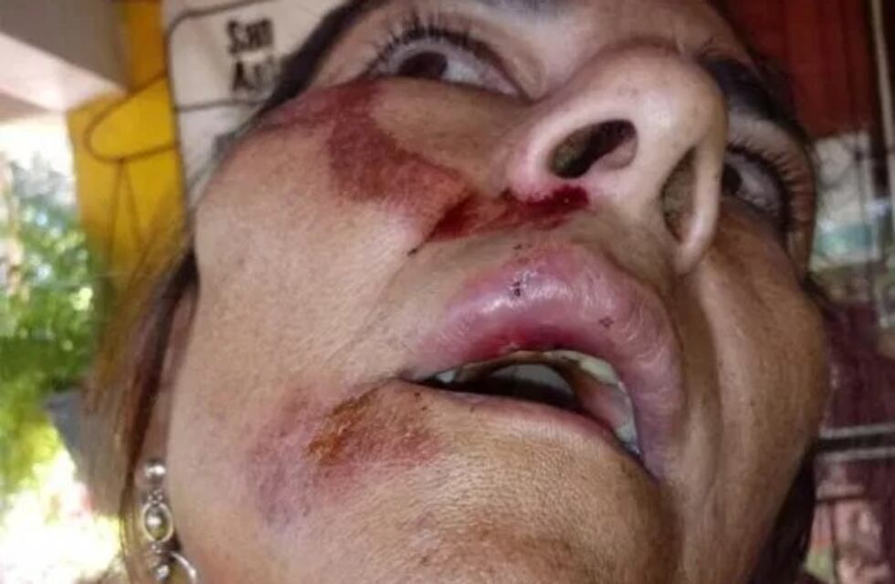 Denunció que un policía la agredió en un boliche