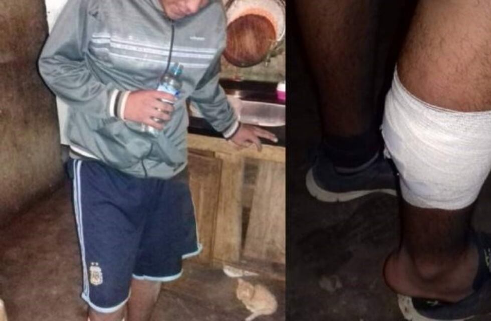 En una persecusión, un policía hirió a un joven que jugaba a la pelota