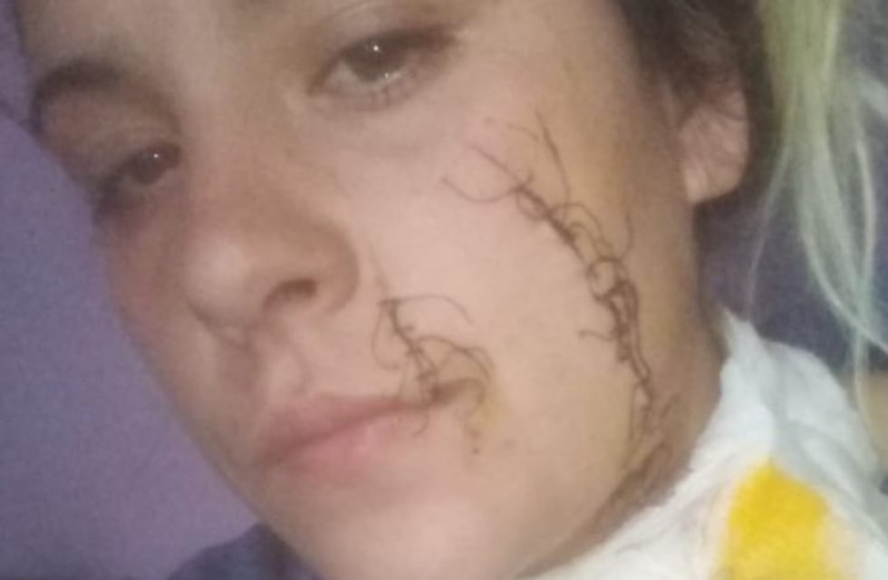 Detuvieron a las dos agresoras de Ayelén Moreno