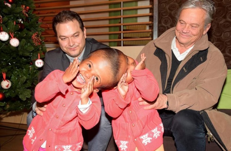 Dos siamesas fueron separadas tras una larga operación