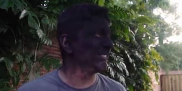 #CarbónChallenge: el nuevo y peligroso reto viral que preocupa a las autoridades\u002E