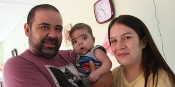 Hoy Jere lleva una vida normal\u002E Se alimenta por sonda, pero en breve comenzará otra vez con la mamadera\u002E