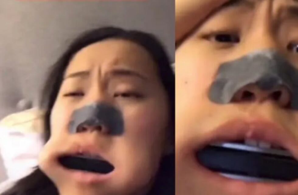 Para conseguir más seguidores: se metió una armónica entera en la boca y terminó en el hospital