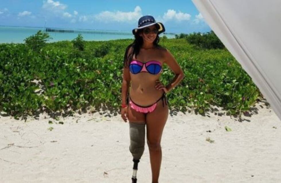 Yerba Buena: no la dejaron entrar a un boliche por tener una pierna ortopédica