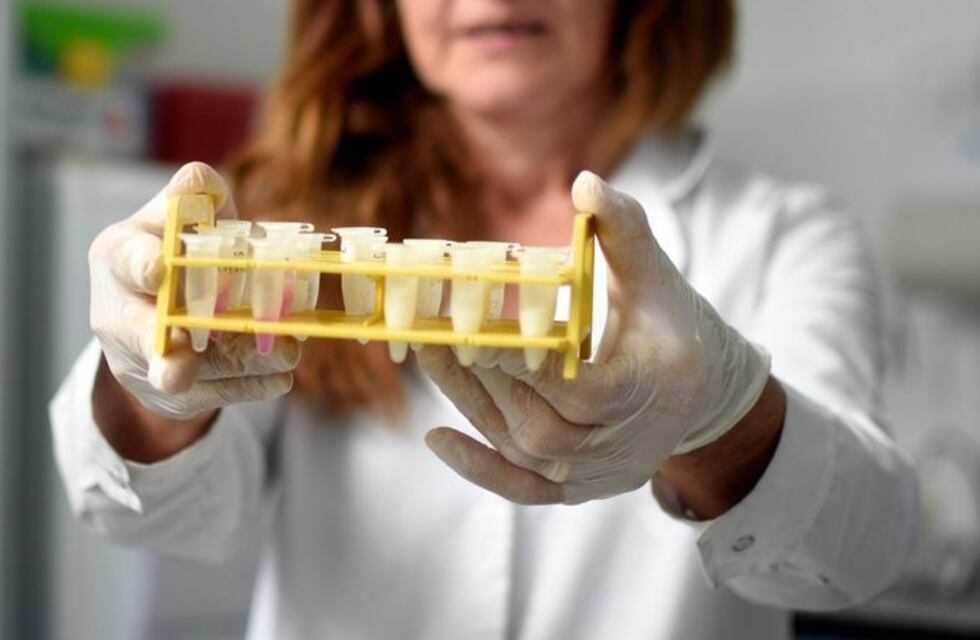La Universidad Nacional de La Plata desarrolla tiras de diagnóstico rápido de Covid-19