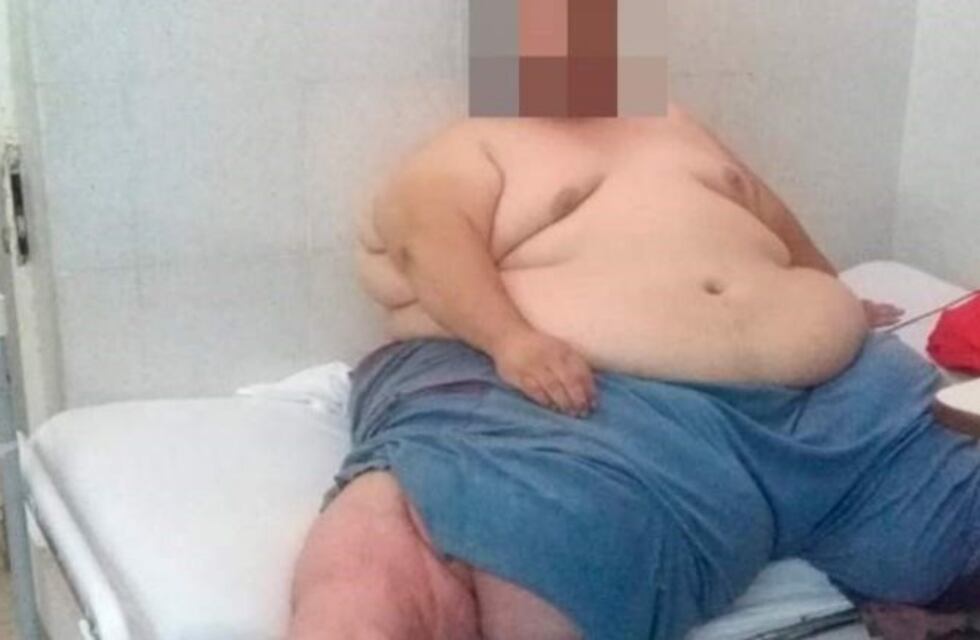 Mega operativo para ayudar a un hombre con obesidad mórbida que cayó de su cama