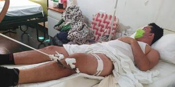 La familia del herido sigue apuntando contra el oficial de la Policía Federal\u002E