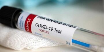 Aumentan los casos de COVID-19 en Entre Ríos\u002E\nCrédito: Web