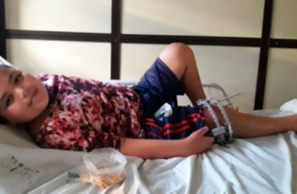 Piden ayuda para Edu, un niño atropellado hace dos años que todavía no pudo caminar