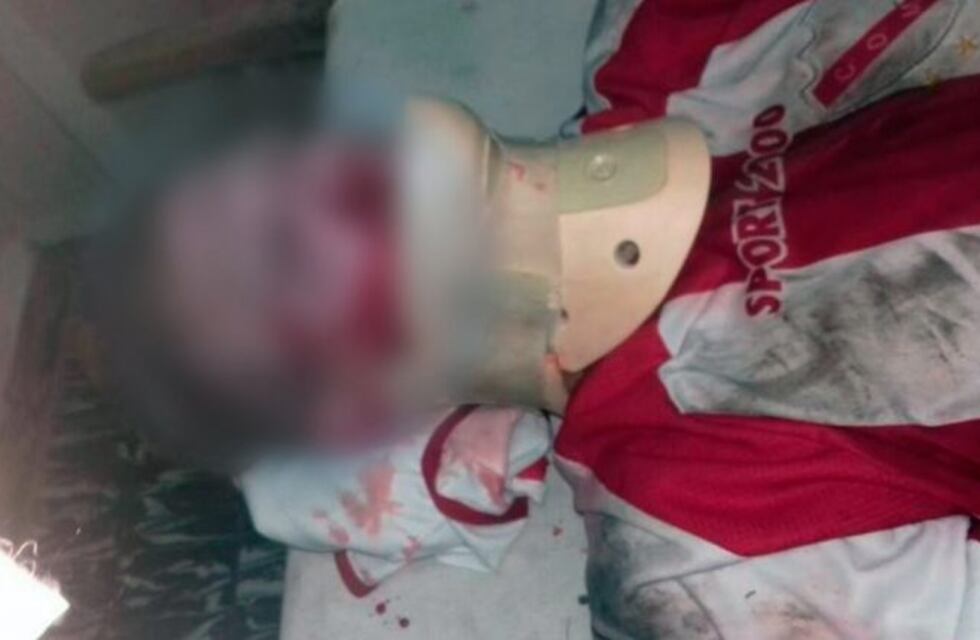 Dejó inconsciente a un jugador en medio del partido y escapó en moto