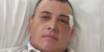 Rodrigo Arballo, hincha de Gimnasia que fue víctima en los incidentes del partido con Boca.