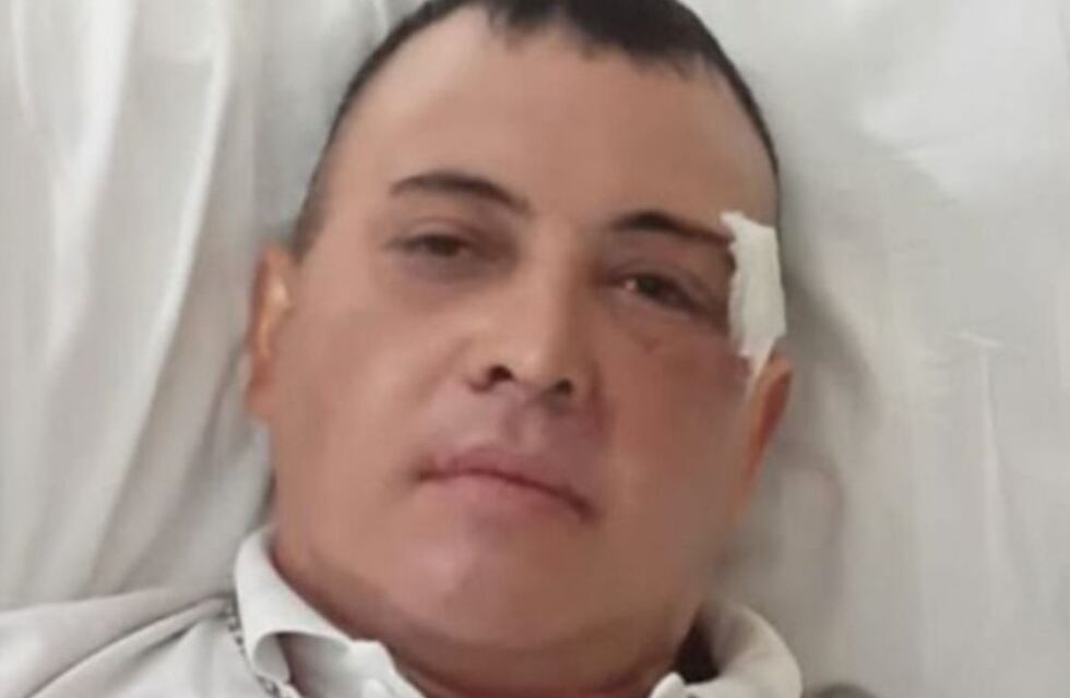 El hincha de Gimnasia que perdió el ojo en la represión pide ayuda para pagar los gastos médicos