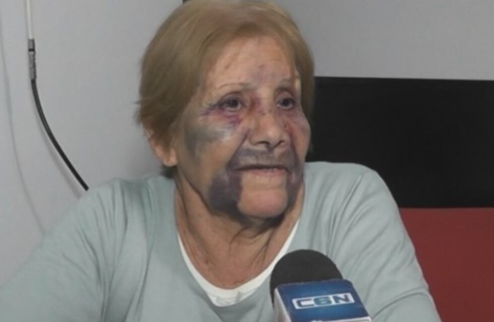 Así dejaron a una jubilada tras un asalto en Corral de Bustos