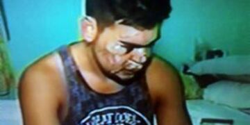 Sergio Silvero fue golpeado a la salida de La Fluvial el u00faltimo su00e1bado a la madrugada.