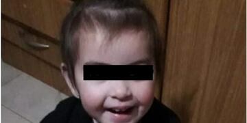 Priscila tiene 18 meses y pelea por su vida\u002E