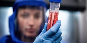 A scientist displays a test sample during diagnostic activity relating to SARS-CoV-2, the virus strain causing the coronavirus disease, at the Szentgothai Research Center, University of Pecs, in Pecs, Hungary\u002E on Monday, April 27, 2020\u002E Hungary’s central bank will start potentially limitless asset purchases next week, the final leg of plans to offset the economic carnage being wrought by the coronavirus\u002E Photographer: Akos Stiller/Bloomberg