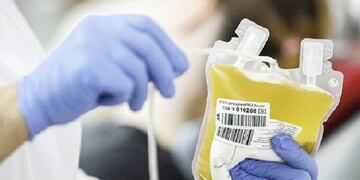 Tratamiento con plasma\u002E