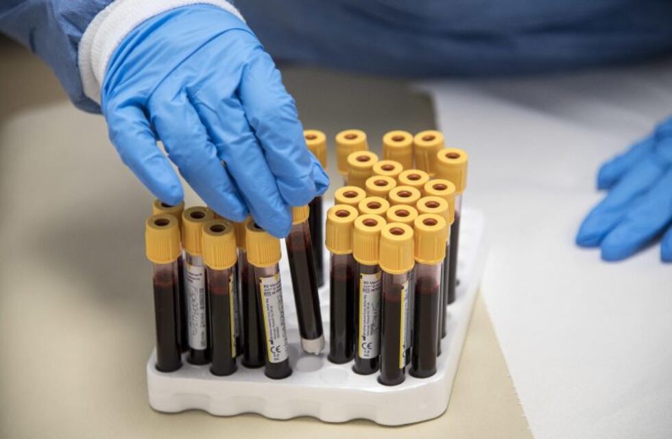Un caso sospechoso de Coronavirus en El Tío y siete casos de dengue en Arroyito