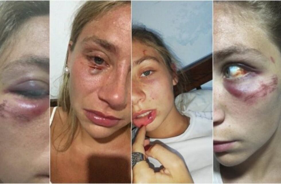 Bernarda denunció a su ex novio: "Le preguntaba por qué me pegaba y me callaba a trompadas"