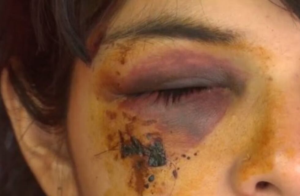 La dejaron inconsciente de un piedrazo por pedirles que no tiraran tiros al aire