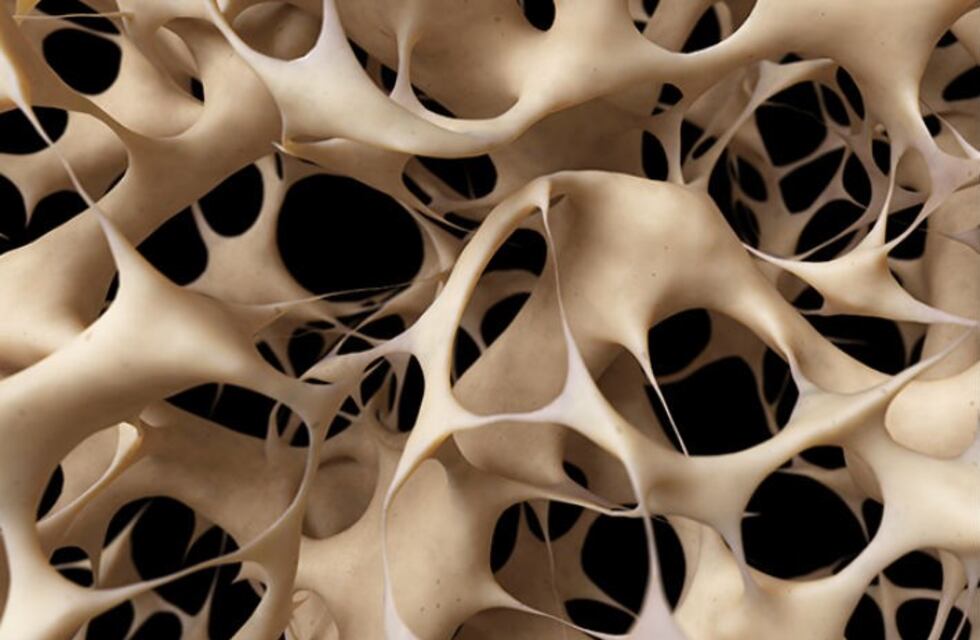 La adolescencia es la etapa ideal para prevenir la osteoporosis