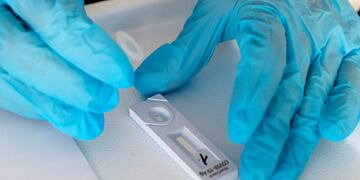A staff member from the Israeli Sheba Medical Center uses a reagent of rapid test for the coronavirus at the Herzliya Hebrew Gymnasium Hight School in the coastal city of Tel Aviv on November 8, 2020, as part of a special program that could enable students to return to school faster than planned\u002E - The program that was launched today, involves as a first step, the screening of students and staff members with a serological test, in search for antibodies\u002E \nAfter that, they will be screened three times per week using a rapid antigen test to determine if they are positive for coronavirus\u002E (Photo by JACK GUEZ / AFP)