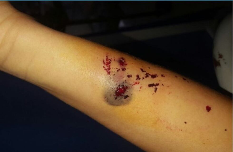 Quisieron asaltar a una policía y ante su resistencia le dispararon