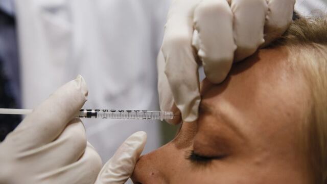 Dr\u002E Keith A\u002E Marcus injects Allergan Inc\u002E Botox between a patient's eyes at the offices of Marcus Facial Plastic Surgery in Redondo Beach, California, U\u002ES\u002E, on Tuesday, April 22, 2014\u002E Valeant Pharmaceuticals International Inc\u002E offered to buy Allergan Inc\u002E, maker of the Botox wrinkle treatment, in a cash-and-stock deal valued at $45\u002E7 billion in the latest step of the Canadian company's plan to become one of the world's largest drugmakers\u002E Photographer: Patrick T\u002E Fallon/Bloomberg *** Local Caption *** Keith A\u002E Marcus eeuu  medico inyecta Botox entre los ojos de un paciente cirugia plastica facial cirugias acuerdo compra fabricante de la arruga de Botox tratamiento