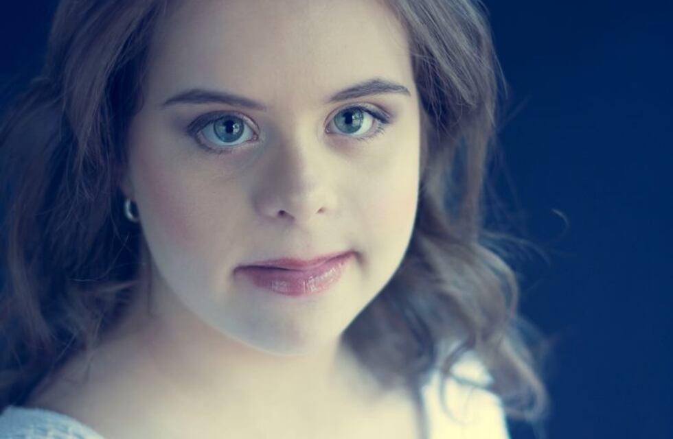 Una joven con síndrome de down sueña con ser modelo