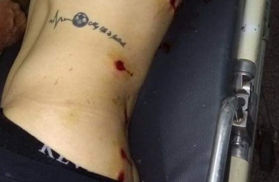 Insólito: la policía reprimió a jugadores e hinchas en la final de la Liga Cañadense