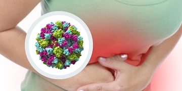 Gastroenteritis en ER