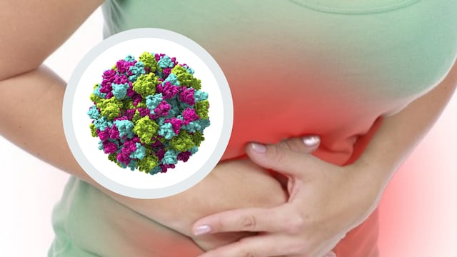 Gastroenteritis en ER