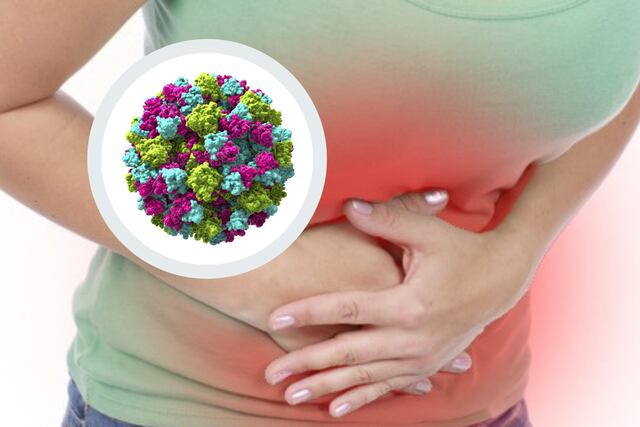 Gastroenteritis en ER