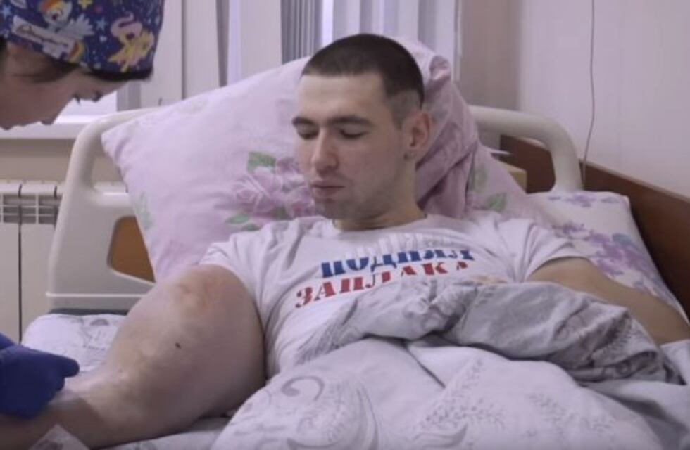 La historia del "Popeye ruso", el hombre que se había inyectado seis litros de aceite en los brazos