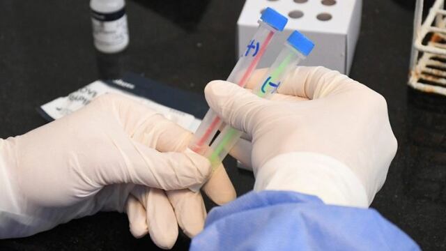 Otros 3 fallecidos por Covid en La Pampa (APN)